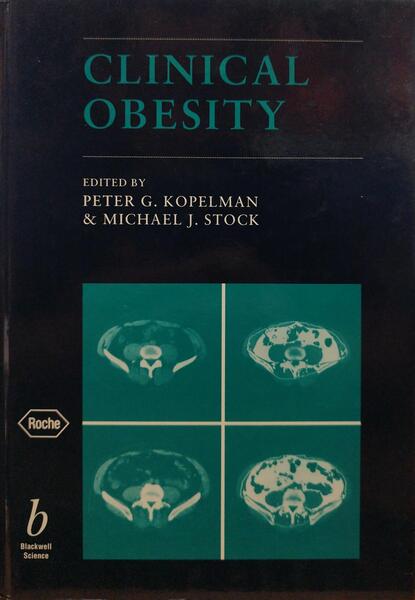 CLINICAL OBESITY.