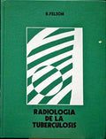 FELSON. (Benjamin) RADIOLOGÍA DE LA TUBERCULOSIS.