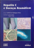 HEPATITE C E DOENÃ‡AS REUMÃTICAS.