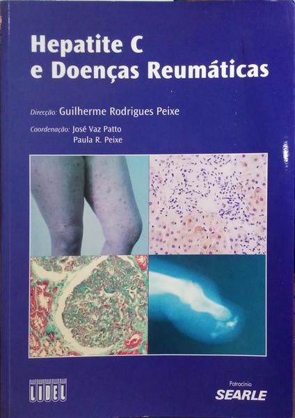 HEPATITE C E DOENÃ‡AS REUMÃTICAS.