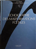 ÉCHOGRAPHIE DES MALFORMATIONS FOETALES.
