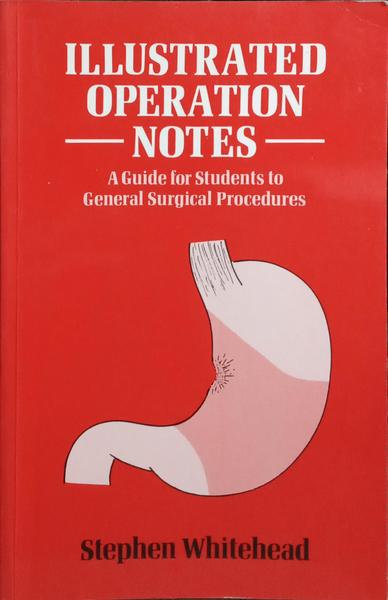 ILLUSTRATED OPERATION NOTES.