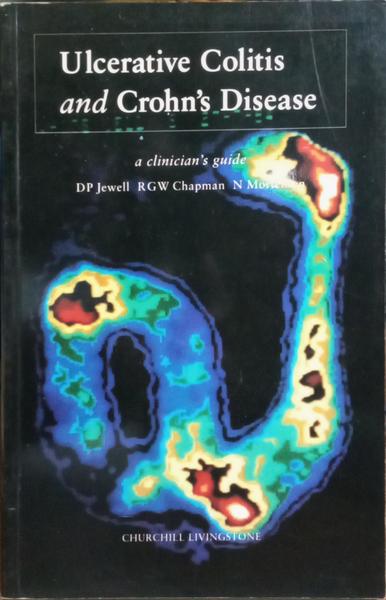 ULCERATIVE COLITIS AND CROHN'S DISEASE.