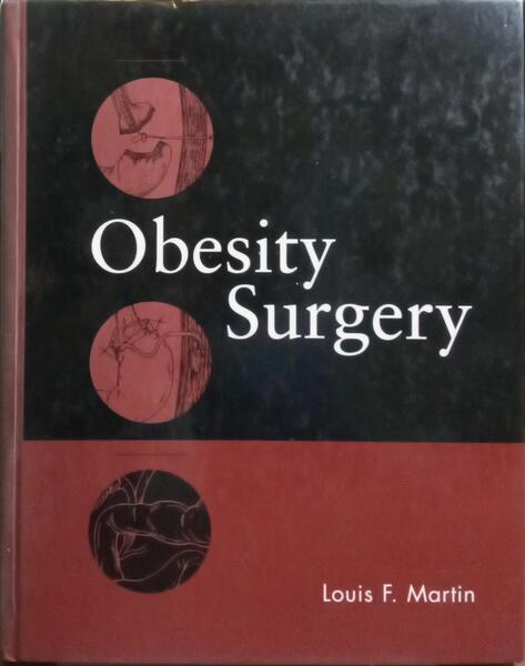 OBESITY SURGERY.