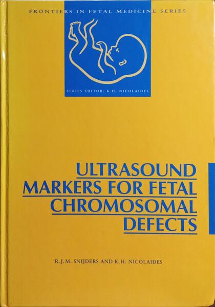 ULTRASOUND MARKERS FOR FETAL CHROMOSOMAL DEFECTS.