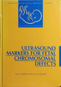 ULTRASOUND MARKERS FOR FETAL CHROMOSOMAL DEFECTS.