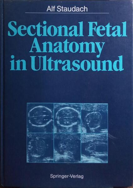 SECTIONAL FETAL ANATOMY IN ULTRASOUND.