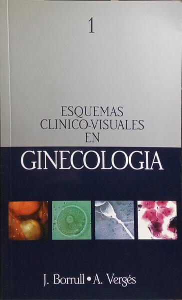 ESQUEMAS CLINICO-VISUALES EN GINECOLOGIA.