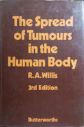 THE SPREAD OF TUMOURS IN THE HUMAN BODY.