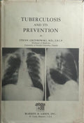 TUBERCULOSIS AND ITS PREVENTION.