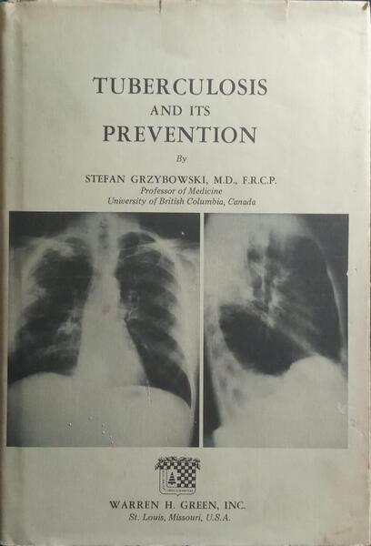 TUBERCULOSIS AND ITS PREVENTION.