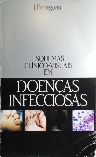 ESQUEMAS CLÍNICO-VISUAIS EM DOENÇAS INFECCIOSAS.