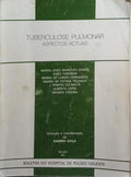 TUBERCULOSE PULMONAR, ASPECTOS ACTUAIS.