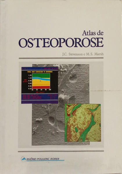 ATLAS DE OSTEOPOROSE.